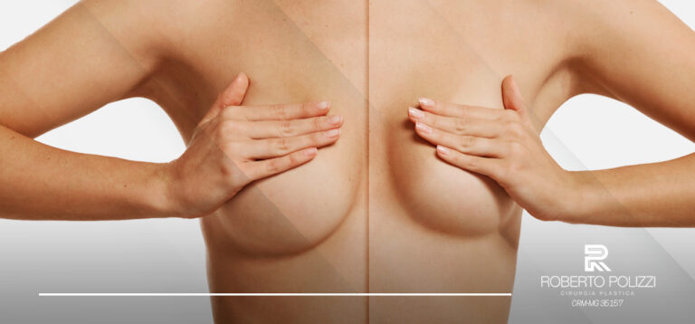 Plástica para Redução de mamas (Mamoplastia) em BH