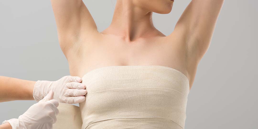 Quanto tempo demora para desinchar após mamoplastia?